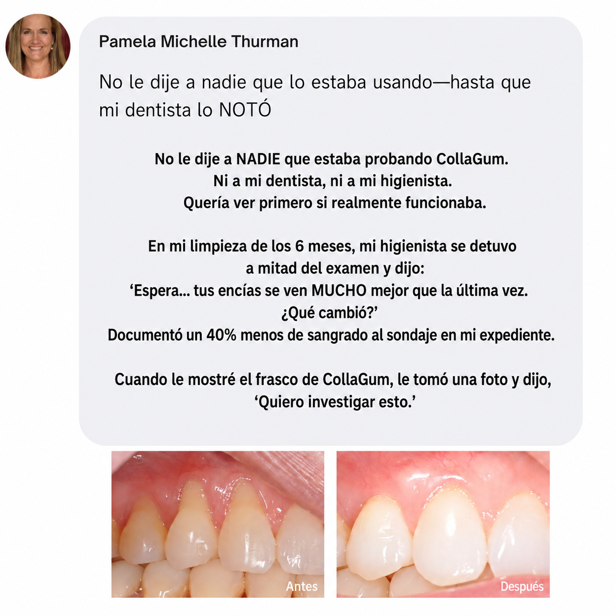Colágeno gingival Norelia: Retracción de encías y regeneración de tejidos.
