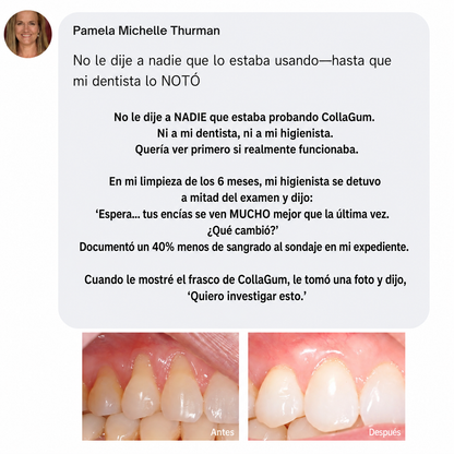 Colágeno gingival Norelia: Retracción de encías y regeneración de tejidos.