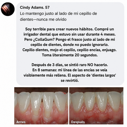 Colágeno gingival Norelia: Retracción de encías y regeneración de tejidos.