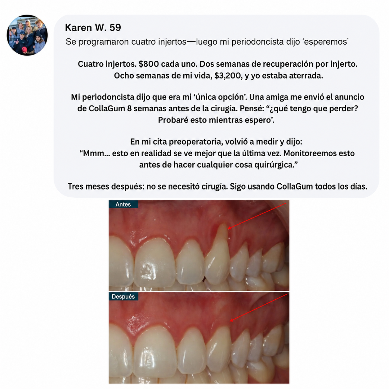 Colágeno gingival Norelia: Retracción de encías y regeneración de tejidos.