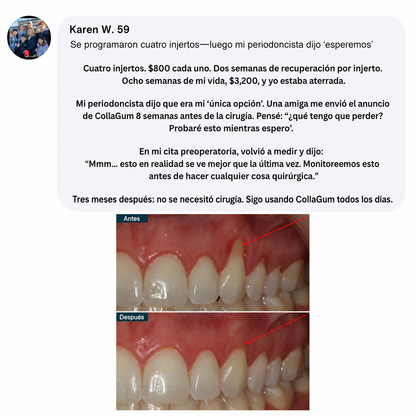 Colágeno gingival Norelia: Retracción de encías y regeneración de tejidos.